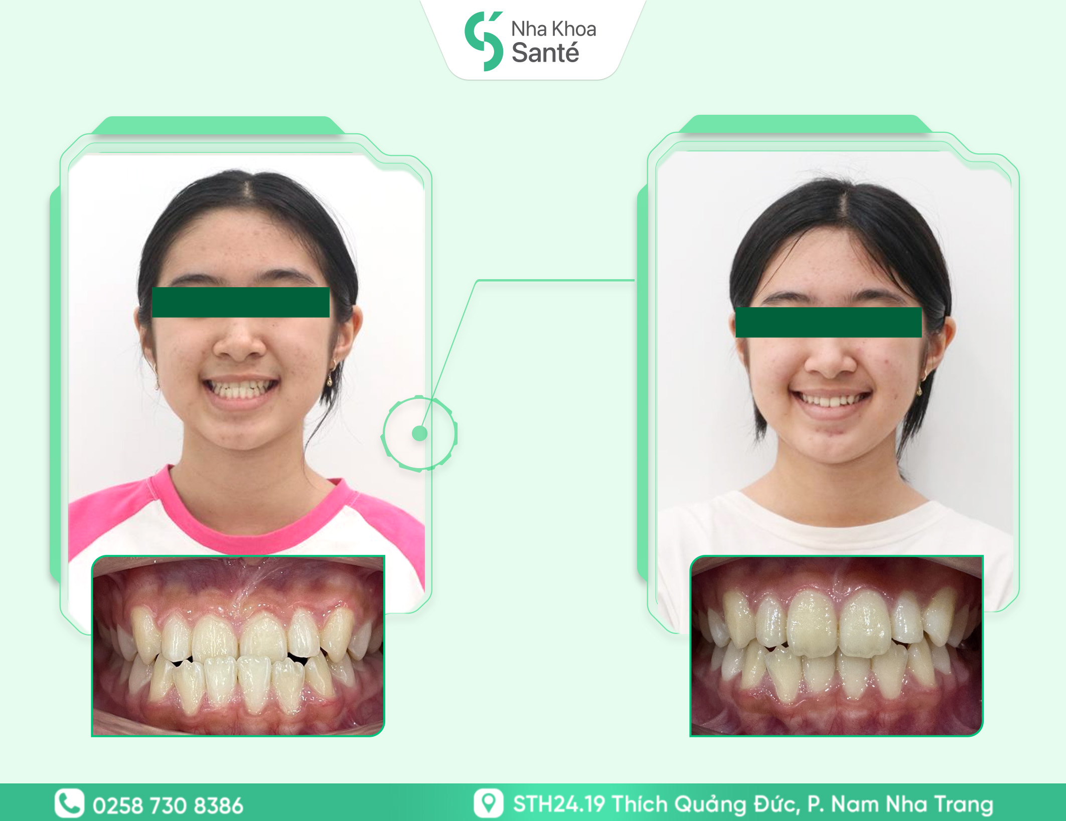Case-chinh-nha-tang-truong (1)
